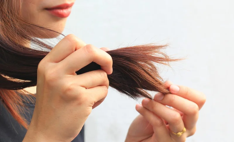 جلوگیری از موخوره